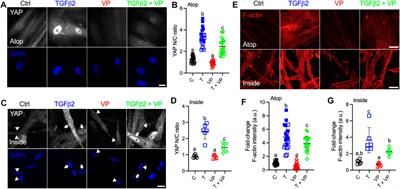 Extracellular Matrix Stiffness and TGFβ2 Regulate YAP/TAZ Activity in Human Trabecular Meshwork Cells